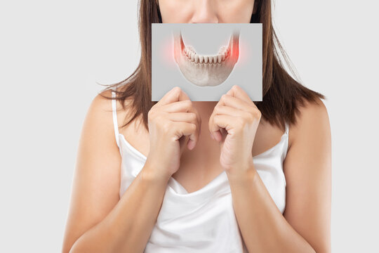 Medical concept showing mandibular inflammation and temporomandibular joint pain. Ideal for topics on dental disorders, TMJ syndrome, and jawbone diagnostics.
