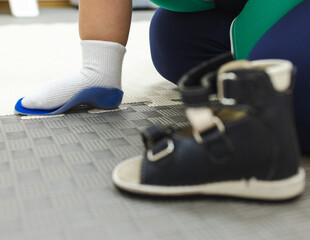 Orthopedist tries on individual orthopedic insoles and shoes for the child's foot to prevent foot...