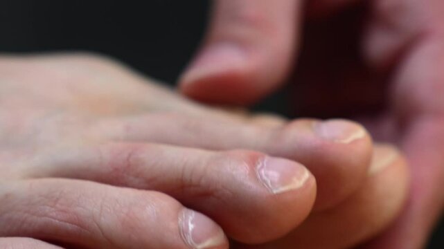 Nails on men's feet.
Unkempt and dry nails close-up.
Cracks on the nail plates on the feet.
Healthy nails on a guy on a dark background.
A man touches his toes