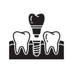 Dental implant in jaw icon with artificial tooth root representing prosthodontics surgery for permanent tooth replacement and oral reconstruction vector solid glyph