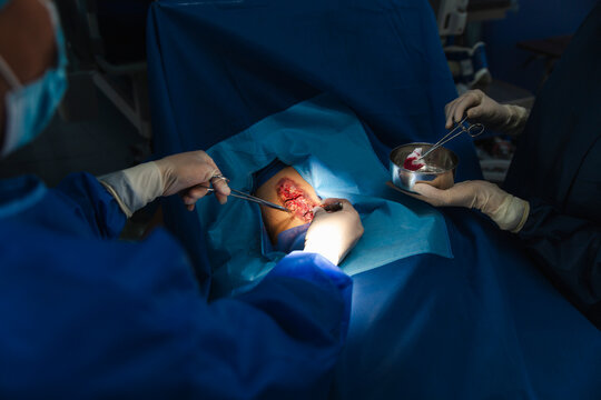Surgical team performing a medical procedure in an operating room