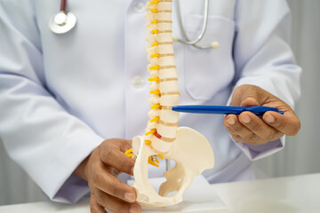Asian doctor holding spinal nerve and bone model, Lumbar spine displaced herniated disc fragment...