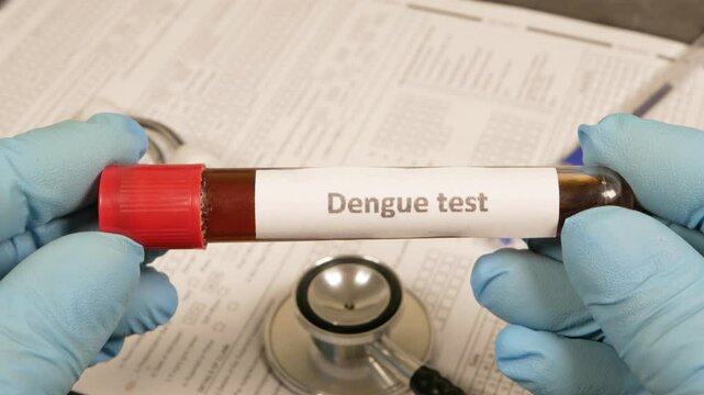 Doctor showing dengue fever test tube
