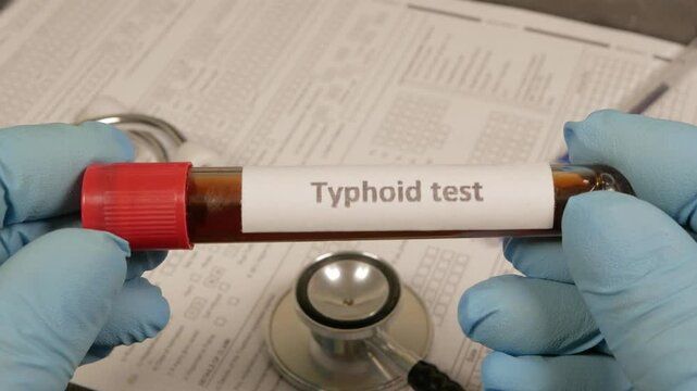 Doctor showing typhoid test tube in laboratory