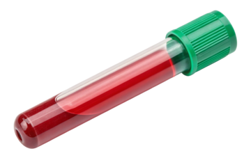 Medical blood sample in a clear tube with a green cap isolated on transparent background