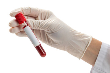 Medical professional wearing white gloves holds a blood sample in a test tube isolated on transparent background
