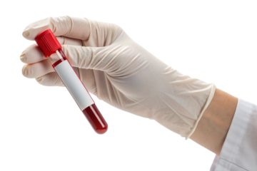 Medical professional wearing white gloves holds a blood sample in a test tube isolated on transparent background