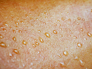 Skin, macro of water drops and texture or body of a person, armhair human and sweat with droplets