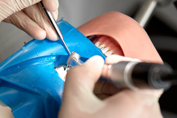 Close-up of dentist hands who is learning to treat teeth on human head mannequin. Hands of medical...