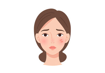 Young woman with sensitive skin displaying concern and redness isolated on transparent background  