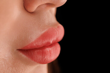 Natural yet polished lip tone with perfect border and no signs of redness or swelling.
