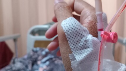 A close-up photo of a patient's hand with an intravenous (IV) line inserted in Hospital Room....