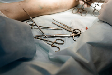 Fototapeta premium Close-up of sterile table with EVLA surgical instruments: scissors, catheter, laser fiber, antiseptic solutions, and syringes.