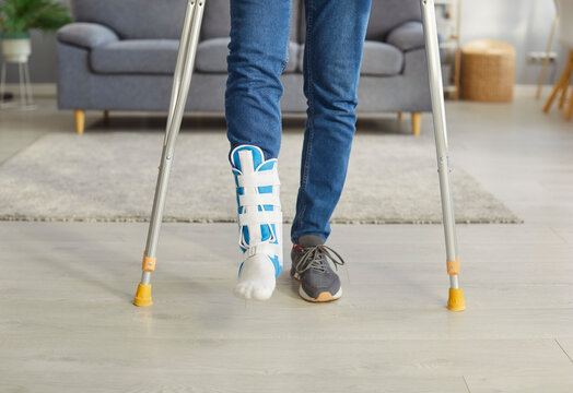 Cropped image of unrecognizable man has broken leg, walking on crutches, wearing fracture fixator, walking in living room at home. Focus on human feet. Physical injuries and rehabilitation