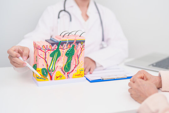 woman Patient consultation Dermatologist with anatomy of skin and hair. Skin disease and Hair loss, Systemic Lupus Erythematosus or SLE, world lupus day, May Melanoma and Skin Cancer Awareness month