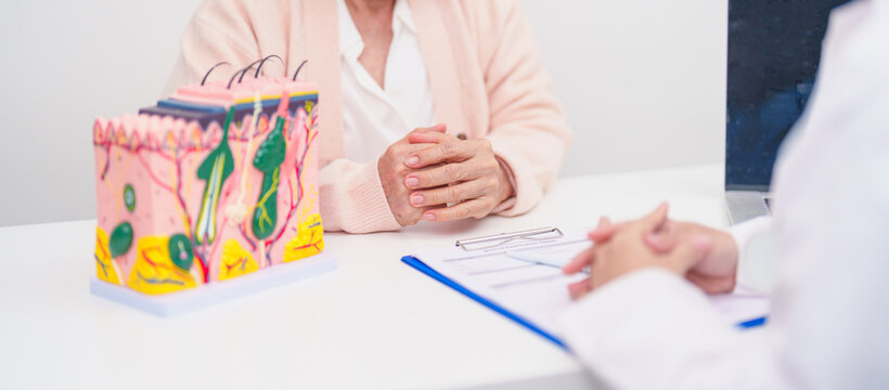 woman Patient consultation Dermatologist with anatomy of skin and hair. Skin disease and Hair loss, Systemic Lupus Erythematosus or SLE, world lupus day, May Melanoma and Skin Cancer Awareness month