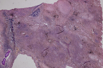 Pathology and Histology Tissue of Mammals under microscope.