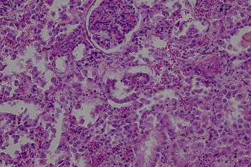 Pathology and Histology Tissue of Mammals under microscope.