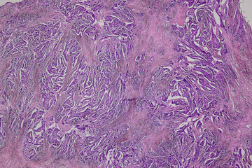 Pathology and Histology Tissue of Mammals under microscope.