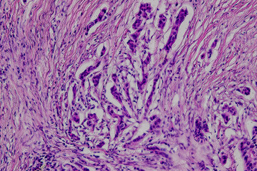 Pathology and Histology Tissue of Mammals under microscope.