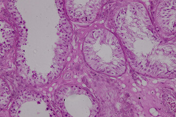 Pathology and Histology Tissue of Mammals under microscope.