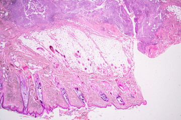 Pathology and Histology Tissue of Mammals under microscope.