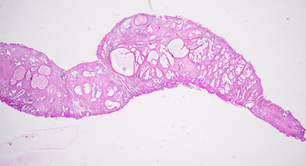 Pathology and Histology Tissue of Mammals under microscope.