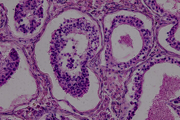 Pathology and Histology Tissue of Mammals under microscope.