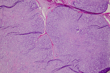 Pathology and Histology Tissue of Mammals under microscope.