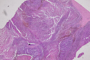 Pathology and Histology Tissue of Mammals under microscope.