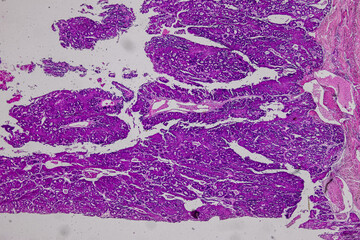 Pathology and Histology Tissue of Mammals under microscope.