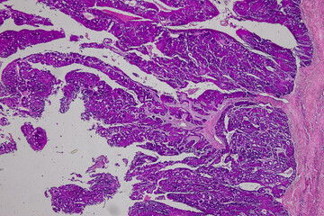 Pathology and Histology Tissue of Mammals under microscope.