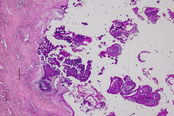 Pathology and Histology Tissue of Mammals under microscope.