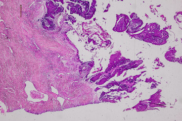 Pathology and Histology Tissue of Mammals under microscope.