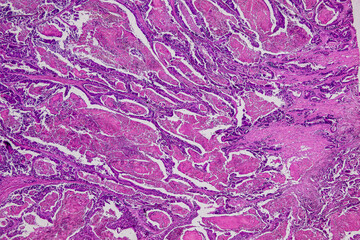 Pathology and Histology Tissue of Mammals under microscope.