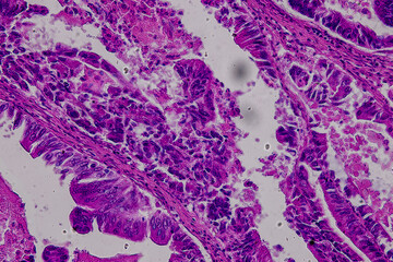Pathology and Histology Tissue of Mammals under microscope.