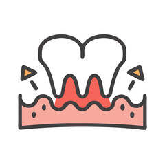 Inflamed Gums Caused by Periodontitis, Tooth and Gums Health