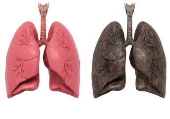 Realistic Lungs Comparison Unhealthy Smoking Related Diseases Transparent