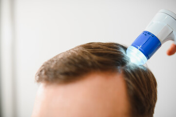 A trichologist examines the hair of a man who begins alopecia. Consultation with a dermatologist....