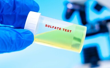 Evaluates sulfate excretion, which may indicate metabolic