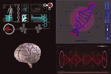 Human brain with various medical reports