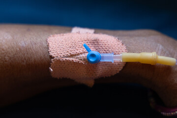 patient hand with IV cannula in clinical environment at indoor
