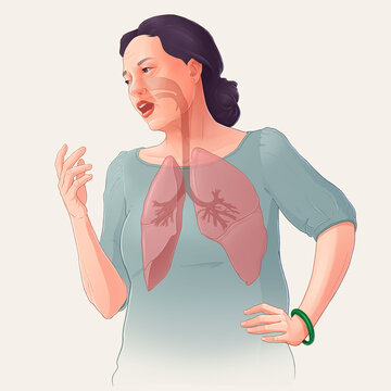 Medical illustration of a mature Asian lady with lung anatomy