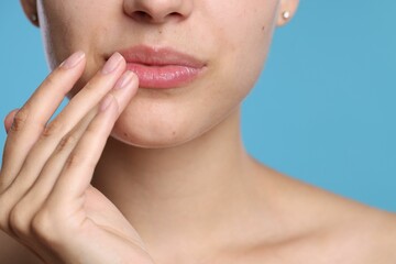 Young woman with lip balm on her lips against light blue background, closeup