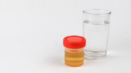 Glass of water and a urine sample container on a white background.