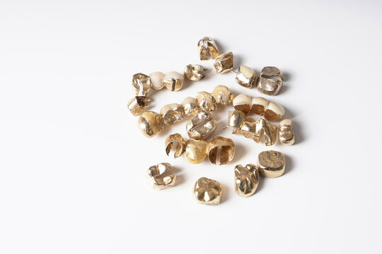 assorted old dental scrap gold