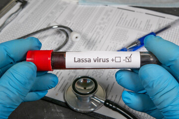 Doctor holding blood sample with positive lassa virus test result