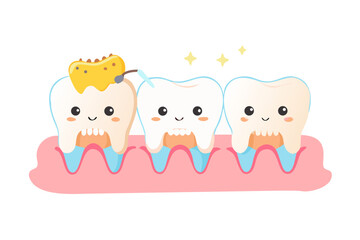 Cute cartoon teeth with dental filling and polishing process showing dental care and hygiene