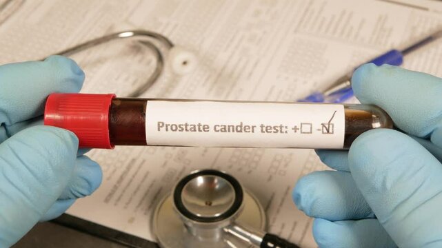 Doctor showing negative prostate cancer test result