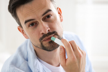 Handsome man applying lip balm onto his lips on blurred light background